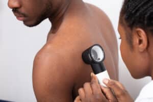 Close up Of A Female Doctor Checking Pigment Skin On Mans Back With Dermatoscope